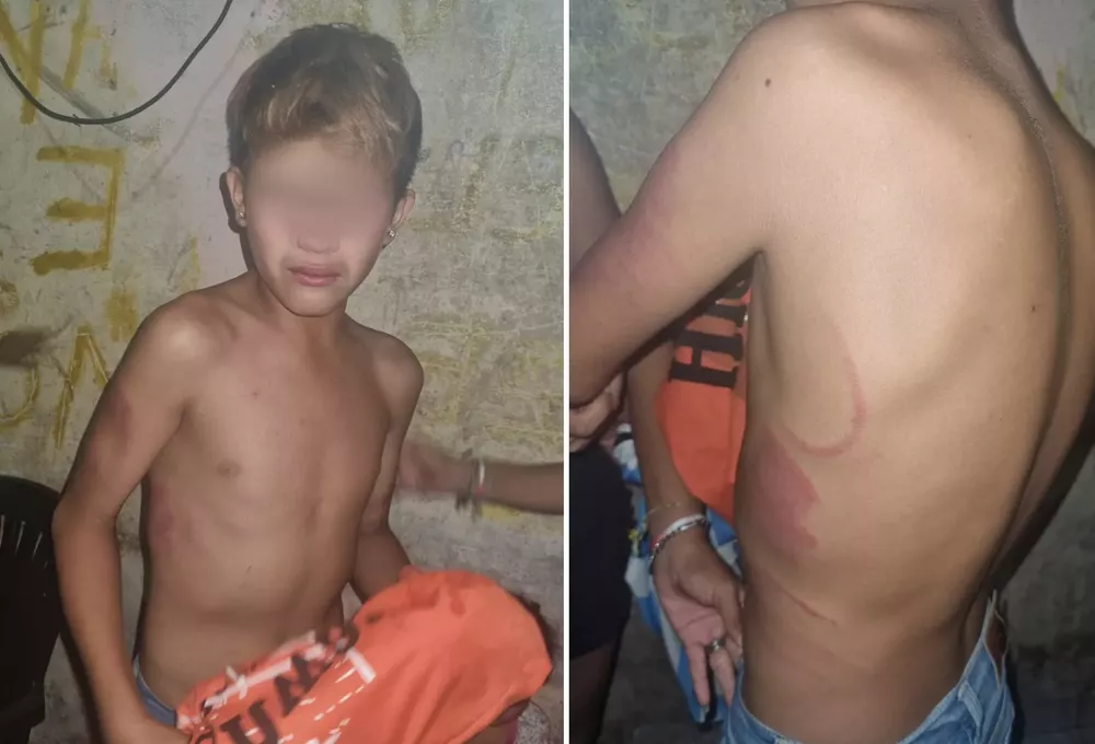 niño golpeado calilegua