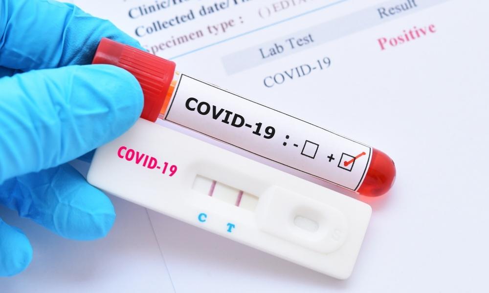 precios-pruebas-coronavirus-mx-gr