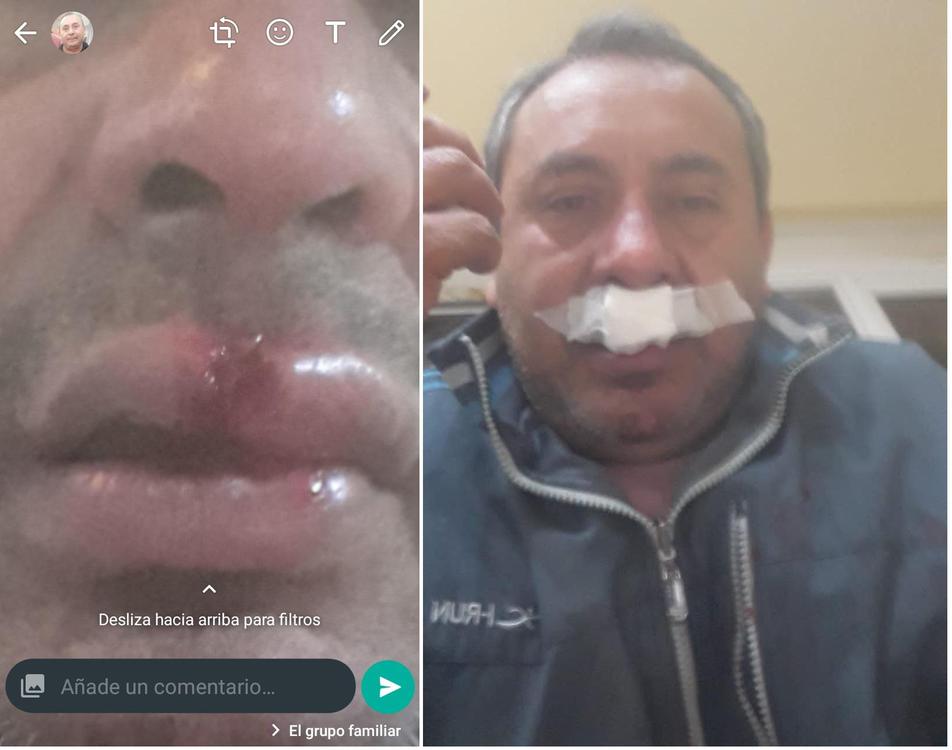 abuelo agredido tapia