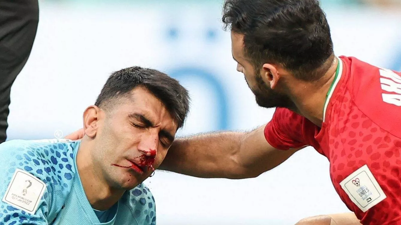 MUNDIAL INGLATERRA IRAN ARQUERO1