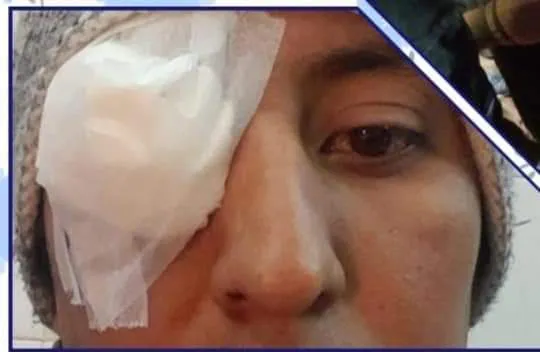 humahuaca joven represioin ojo