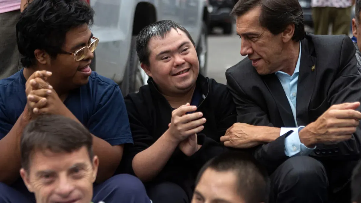 sadir sindrome de down