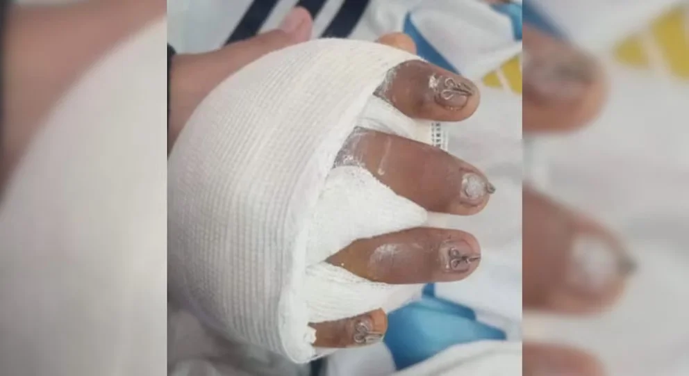 CHICO ACCIDENTEADO ESCUELA PALPALA