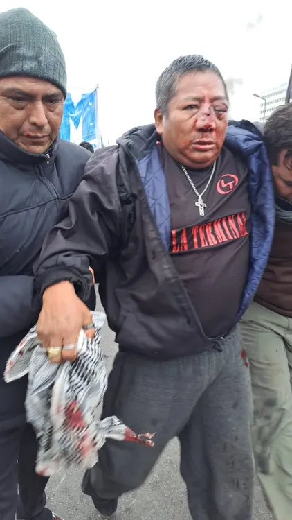 HERIDO REPRESION JUJUY1