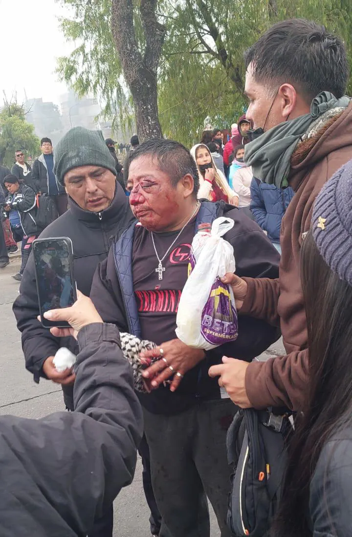HERIDO REPRESION JUJUY