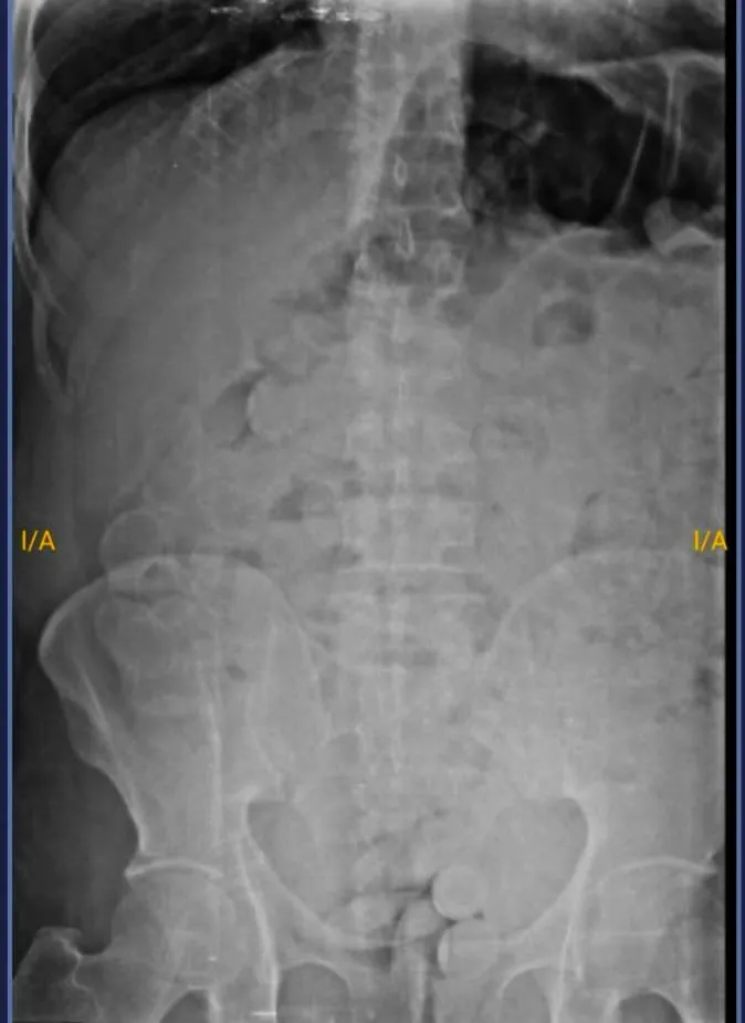 jujuy-capsuleros-detenidos-2_kilos_de_cocaina-182_capsulas_3