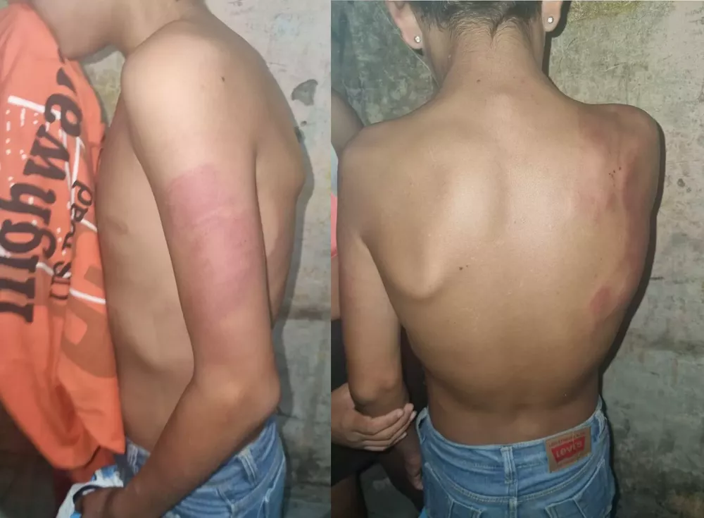 niñogolpeado calilegua1